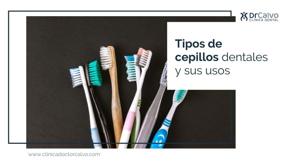 Expansión ataque Retocar Tipos de cepillos dentales y sus usos | Clínica Doctor Calvo Sevilla